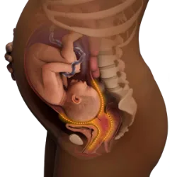 O Dia Internacional pelo Fim da Fístula Obstétrica, celebrado em 23 de maio,