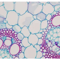 Unicellular being – A living being consists of a single cell, which can be prokaryotic or eukaryotic. Bacteria are examples of prokaryotic unicellular beings, that is, they are prokaryotic cells. Paramecia, amoebae and yeast are examples of eukaryotic unicellular beings, that is, they are eukaryotic cells. Multicellular being – A living being is made up of more than one cell, generally presenting a diversity of cells with specific functions. All multicellular living beings are eukaryotes, that is, all their cells are eukaryotic. Green, brown or red algae, mushrooms, plants and animals are examples of multicellular beings.