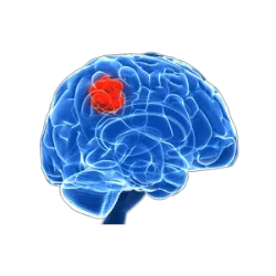 O Dia Internacional do Tumor Cerebral, observado em 8 de junho, é uma data d